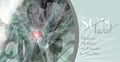 sontarotcover.jpg